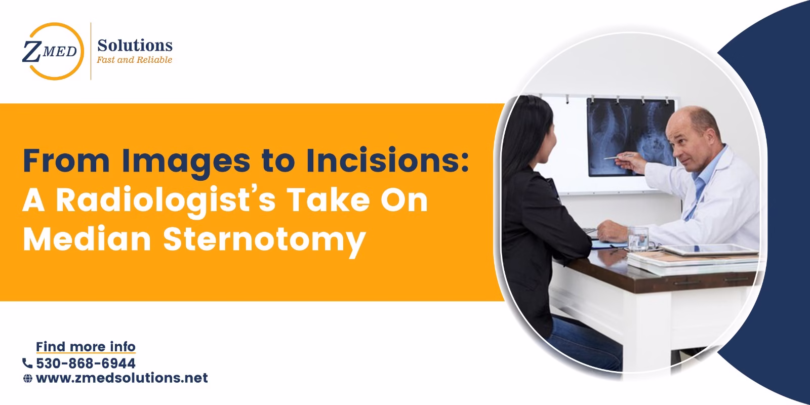 Median Sternotomy Median Sternotomy
