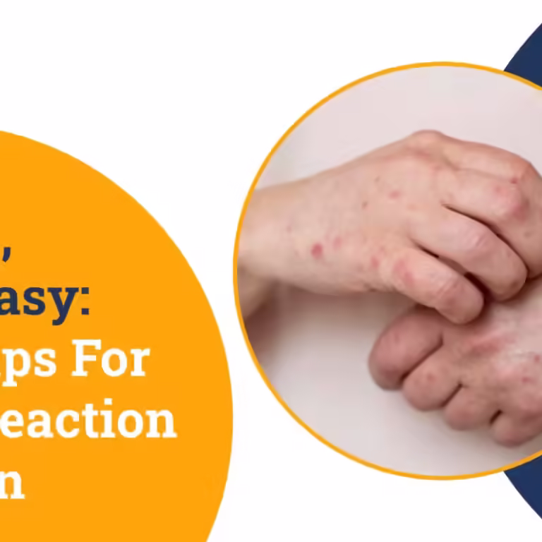 Allergic Reaction Prevention Allergic Reaction Prevention