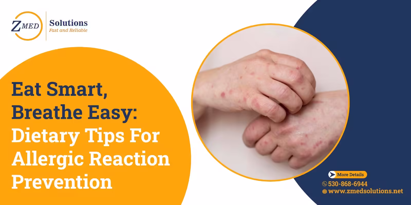 Allergic Reaction Prevention Allergic Reaction Prevention