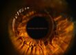 Tele-ophthalmology Services