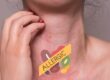 allergic testing services