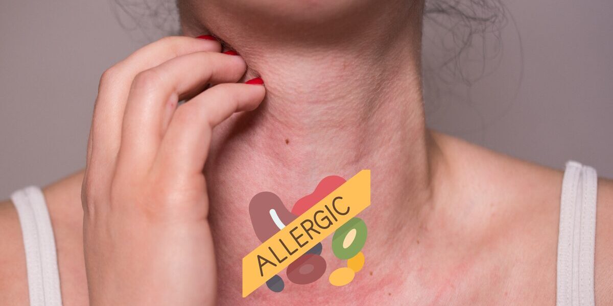 allergic testing services