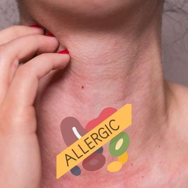 allergic testing services