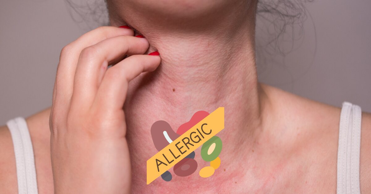 allergic testing services