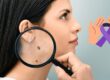 Skin cancer screening services