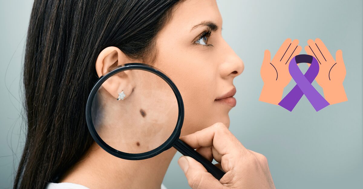 Skin cancer screening services