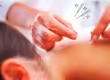 Common Acupuncture CPT Codes