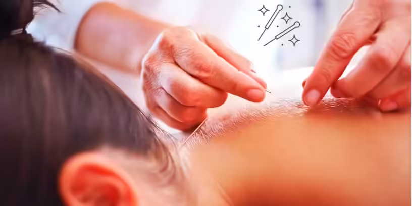 Common Acupuncture CPT Codes