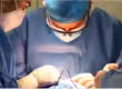 Cataract Surgery CPT Codes
