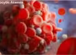 Macrocytic Anemia ICD-10 Code
