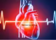 NSTEMI ICD-10 Code